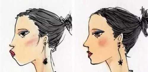 鼻子整形后能否永久保持？全面解析鼻子整形手術的持久性，鼻子整形手術的持久性與永久保持的可能性解析