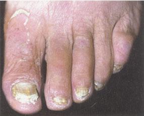 全面解析，100種皮膚病對照表圖片，100種皮膚病對照表圖片，全面解析皮膚病癥狀與類型