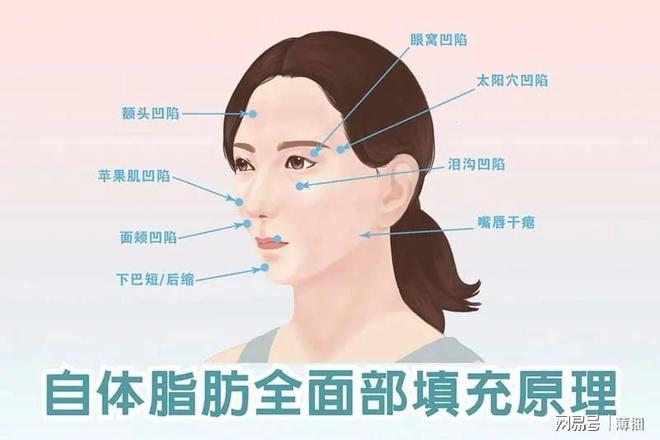 脂肪填充后幾天開始存活，全面解析脂肪填充過程及其恢復時間，全面解析脂肪填充過程，術(shù)后幾天脂肪開始存活及恢復時間揭秘