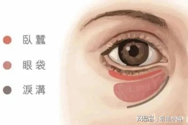 眼袋切除手術(shù)費(fèi)用詳解，價(jià)格因素與如何選擇合適的手術(shù)方案，眼袋切除手術(shù)費(fèi)用解析，了解價(jià)格因素與選擇最佳手術(shù)方案