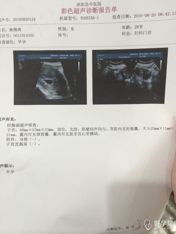 懷孕多少天可以查出來，全面解析早期妊娠檢測(cè)方式，懷孕多少天可以檢測(cè)出來？早期妊娠檢測(cè)方式的全面解析