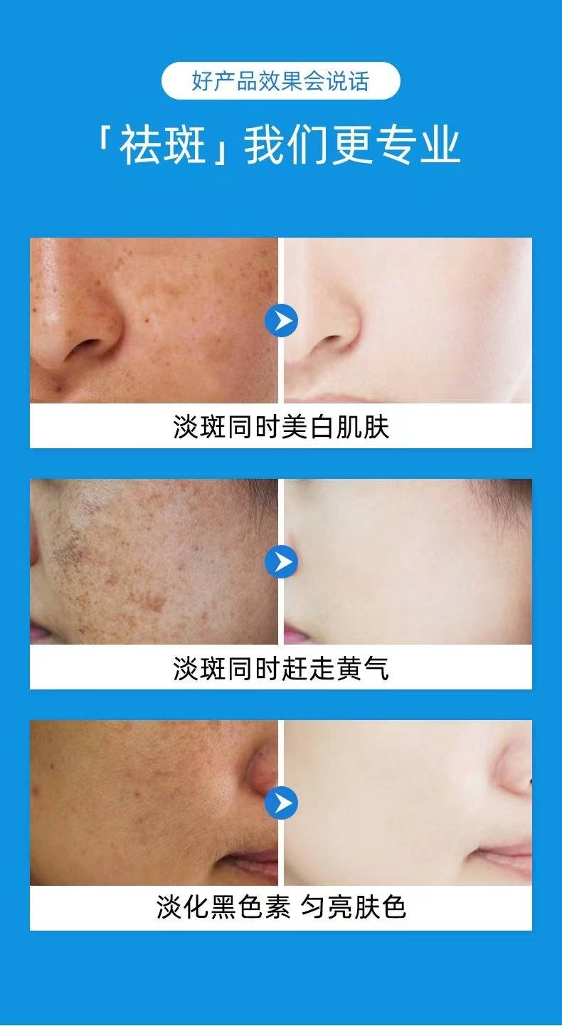 揭秘祛斑最佳方法，如何達(dá)到最佳祛斑效果？，揭秘最佳祛斑方法，實(shí)現(xiàn)最佳效果的秘訣！