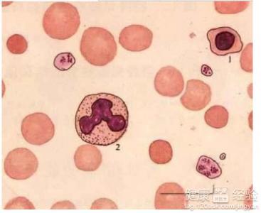 地中海貧血能生小孩嗎，全面理解與生育決策，地中海貧血患者的生育決策，全面理解與探討