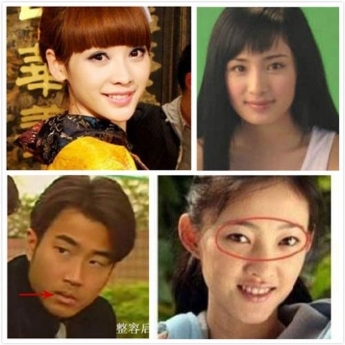 整容失敗明星整容前后圖片，深度探討與反思，整容失敗的明星，前后對(duì)比與深度探討反思