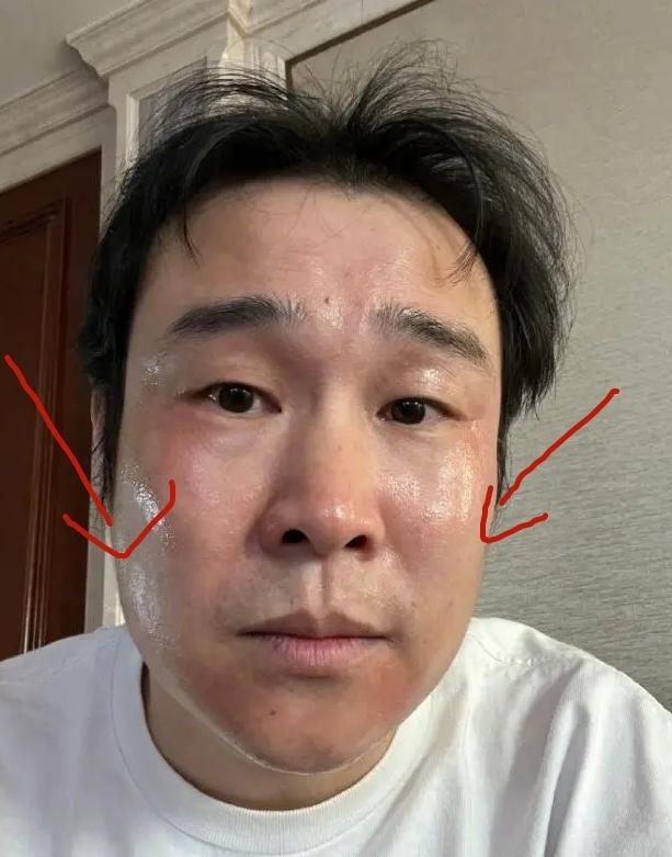 頭痛欲裂，感覺要爆炸了怎么辦？全面解析頭痛原因與應對之策，頭痛欲裂，緊急解析原因與應對之策，全面攻略助你擺脫頭痛困擾