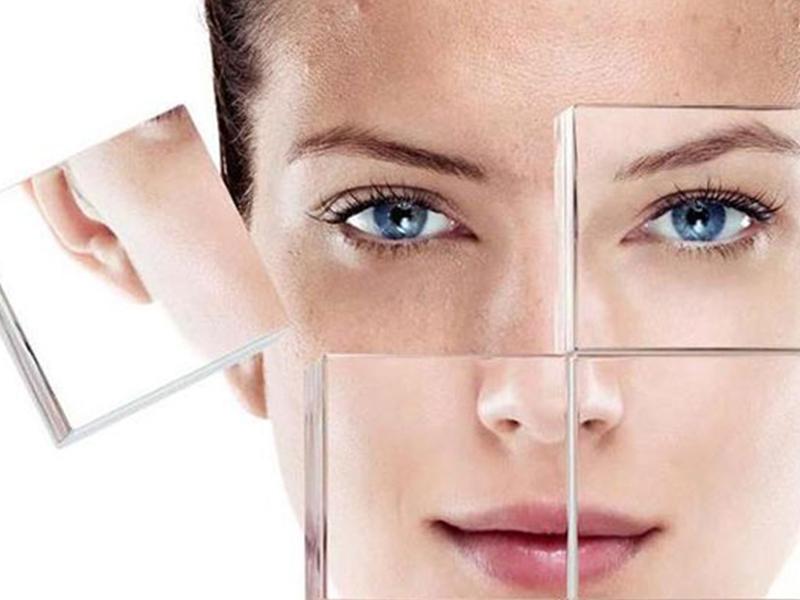 做完光子嫩膚后的注意事項全面指南，光子嫩膚后的全面護理指南，注意事項詳解