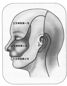 神經(jīng)痛的最佳治療方法，全面解析與個性化護理策略，神經(jīng)痛的最佳治療方法，全面解析與個性化護理方案