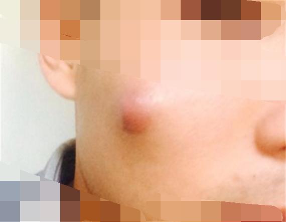 臉上一摸全是小顆粒，原因解析與應(yīng)對方法，臉部小顆粒密布，原因解析及應(yīng)對方法