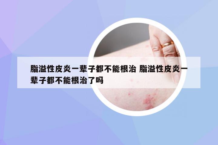 脂溢性皮炎，并非終身無(wú)法根治的疾病，脂溢性皮炎并非無(wú)法根治，治療策略助你擺脫困擾